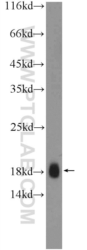 Western Blot (WB) analysis of HeLa cells using TR2IT1 Polyclonal antibody (25753-1-AP)