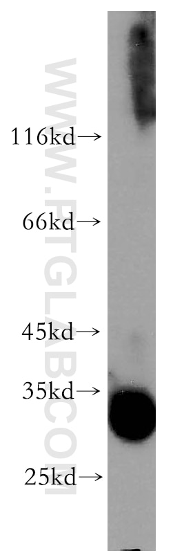 Western Blot (WB) analysis of A549 cells using TRA2A Polyclonal antibody (12079-1-AP)