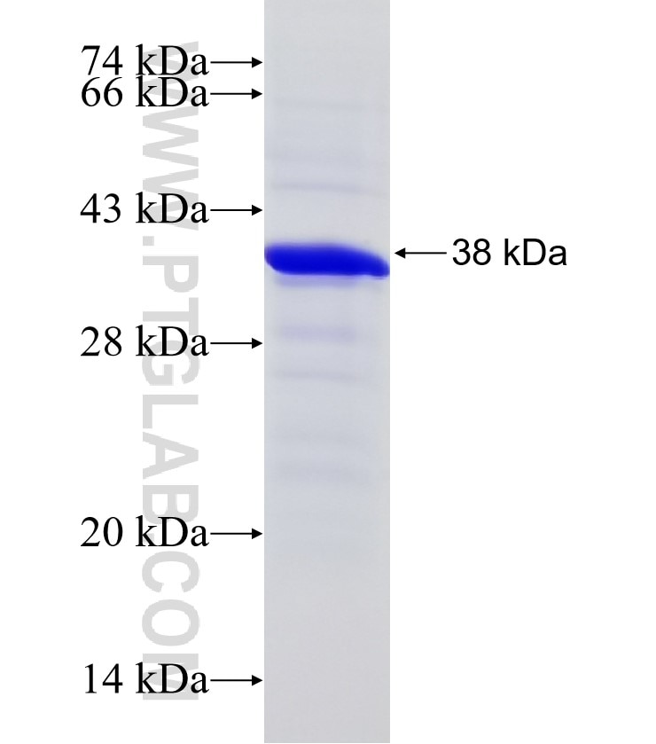TRA2A fusion protein Ag2760 SDS-PAGE