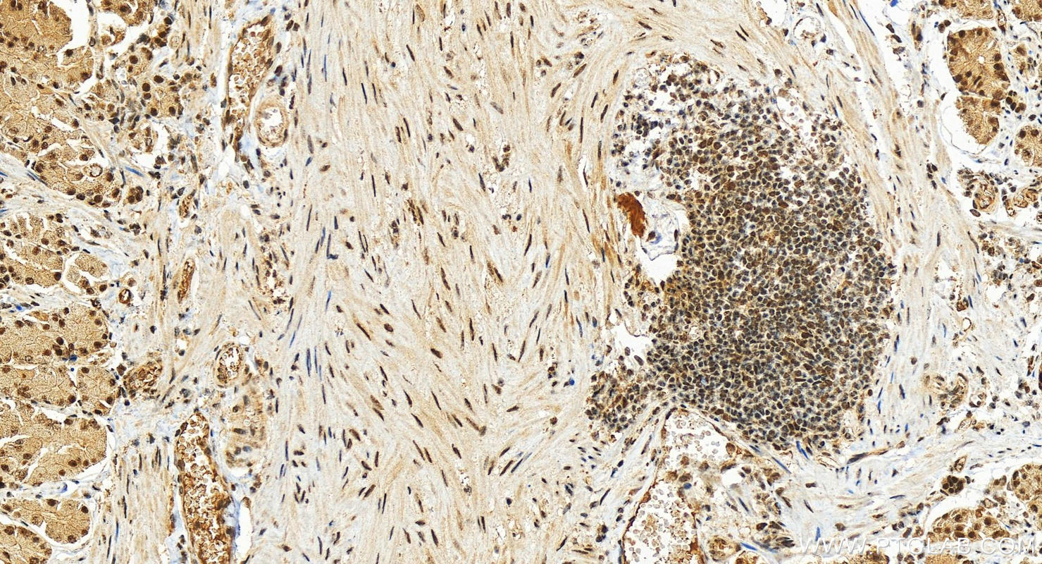 Immunohistochemistry (IHC) staining of human stomach tissue using TRA2B Polyclonal antibody (29627-1-AP)