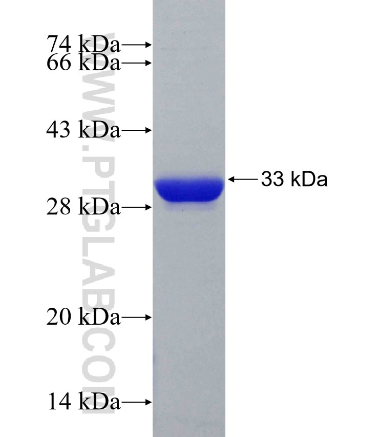 TRA2B fusion protein Ag30637 SDS-PAGE