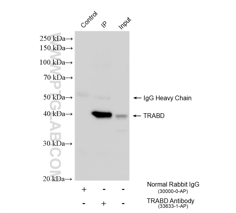 Immunoprecipitation (IP) experiment of HeLa cells using TRABD Polyclonal antibody (33633-1-AP)