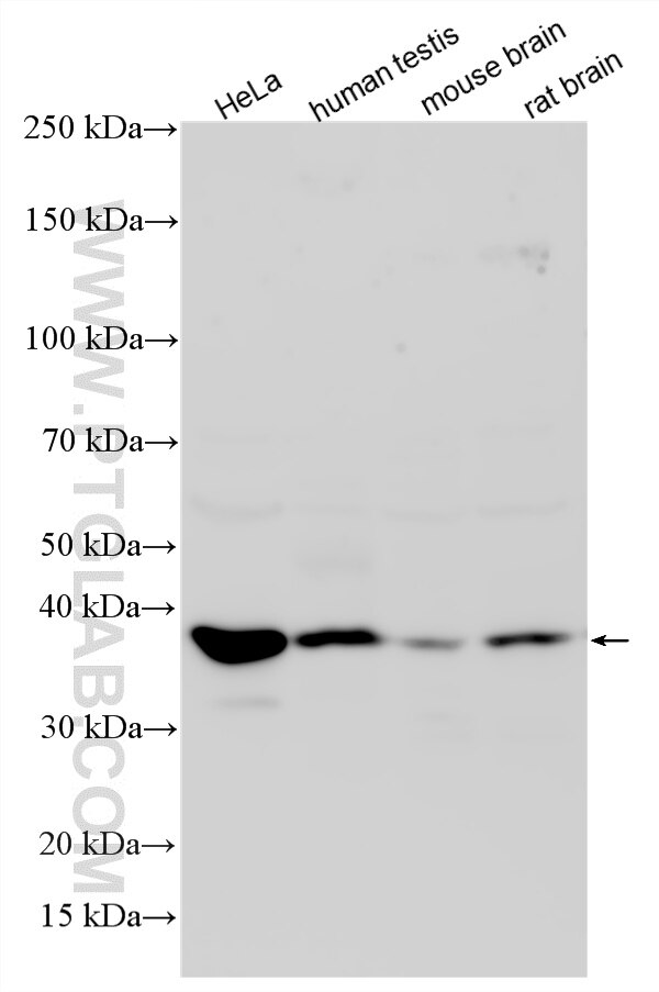 Western Blot (WB) analysis of various lysates using TRABD Polyclonal antibody (33633-1-AP)