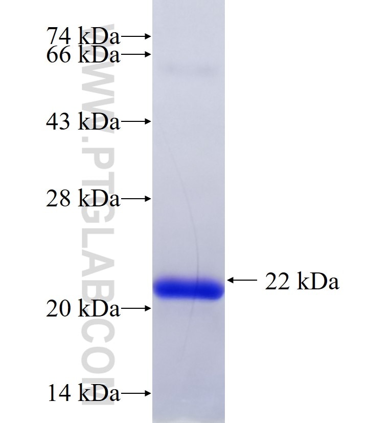 TRABD2A fusion protein Ag30271 SDS-PAGE TRABD2A fusion protein Ag30271 SDS-PAGE