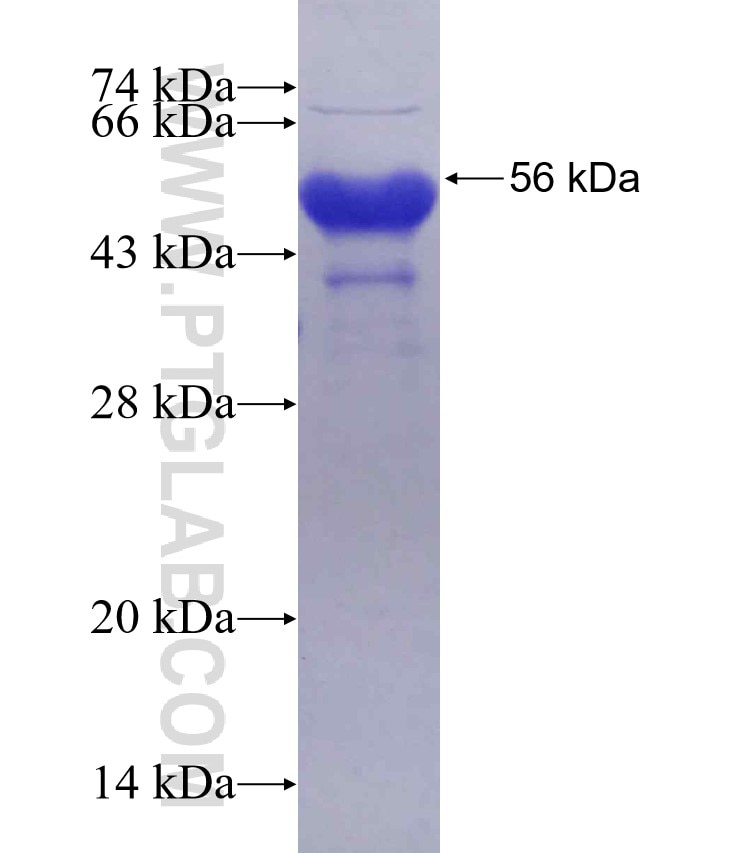 TRABD2B fusion protein Ag30248 SDS-PAGE