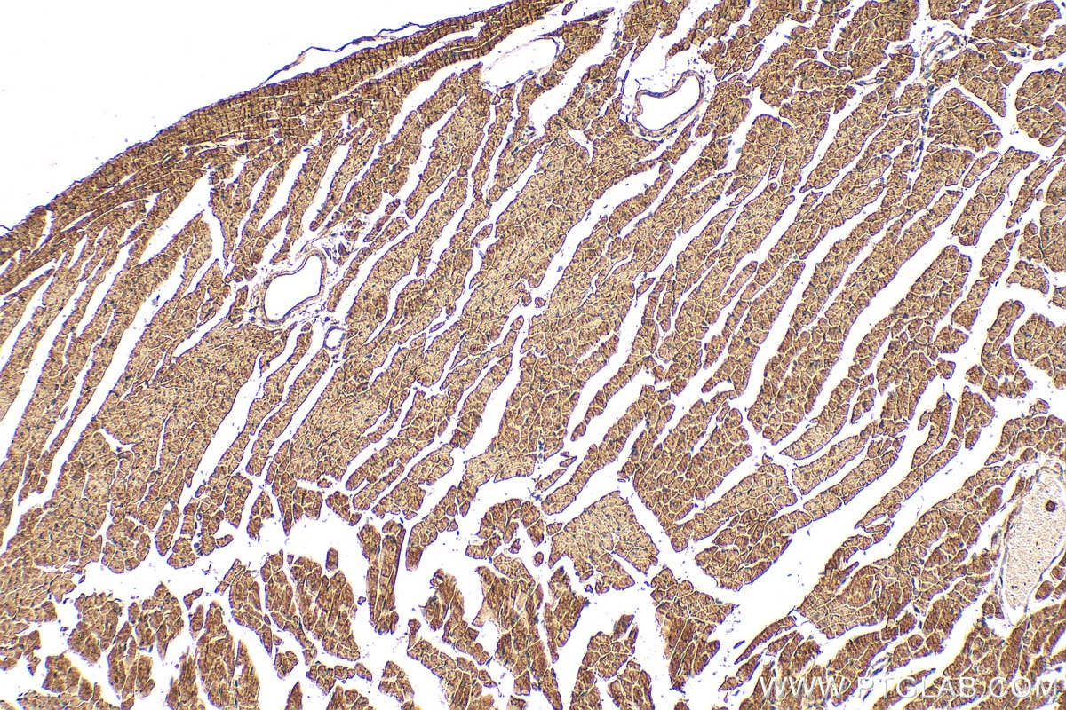 Immunohistochemistry (IHC) staining of mouse heart tissue using TRADD Polyclonal antibody (15468-1-AP)