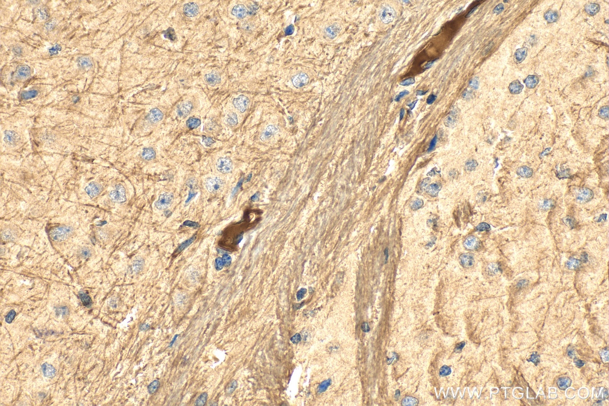 Immunohistochemistry (IHC) staining of mouse brain tissue using TRADD Polyclonal antibody (15468-1-AP)