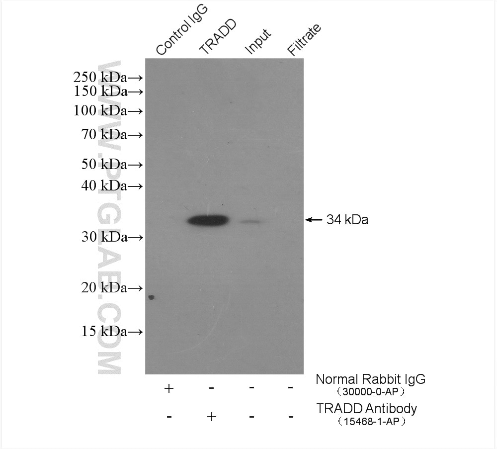 Immunoprecipitation (IP) experiment of Jurkat cells using TRADD Polyclonal antibody (15468-1-AP)