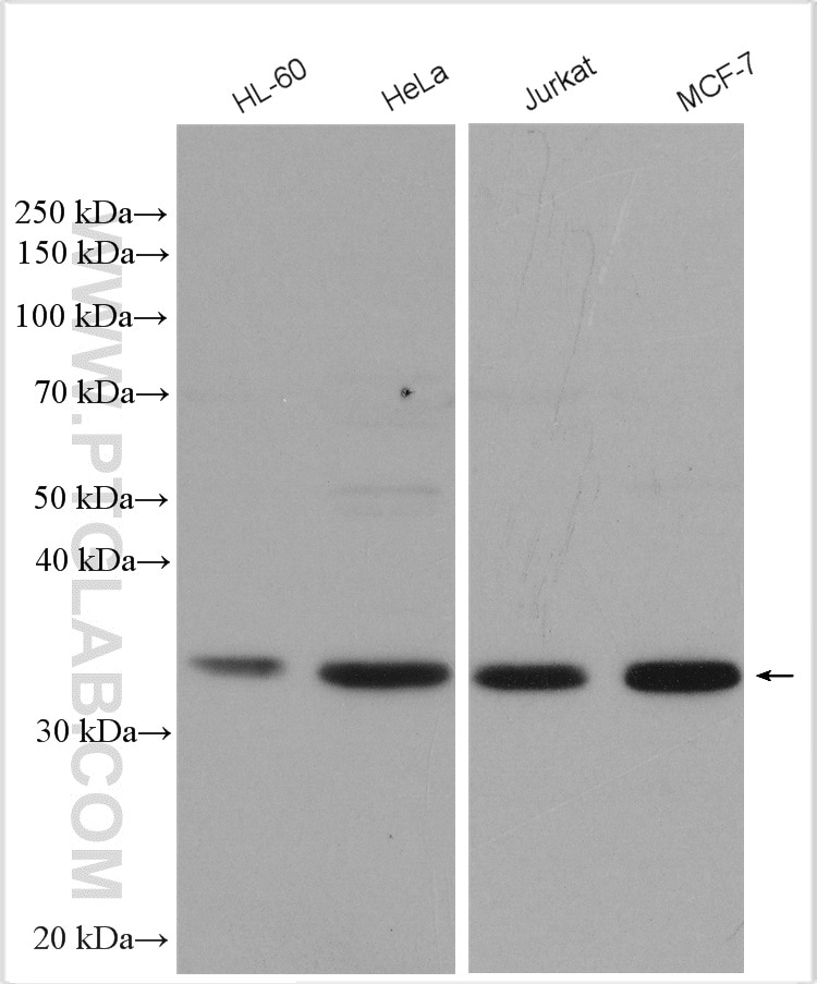 Western Blot (WB) analysis of various lysates using TRADD Polyclonal antibody (15468-1-AP)