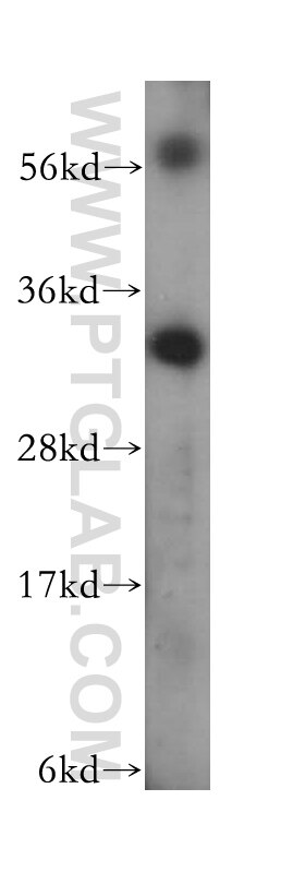 TRADD Polyclonal antibody