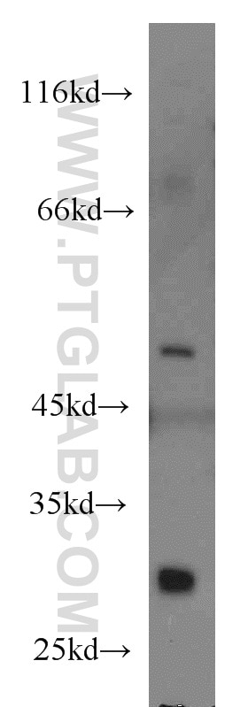 Western Blot (WB) analysis of Jurkat cells using TRAF1 Polyclonal antibody (11543-1-AP)