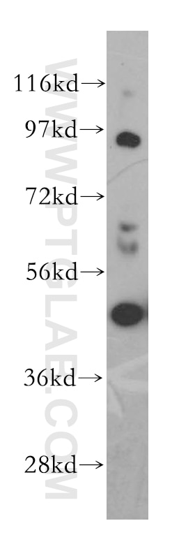 Western Blot (WB) analysis of Jurkat cells using TRAF1 Polyclonal antibody (11543-1-AP)