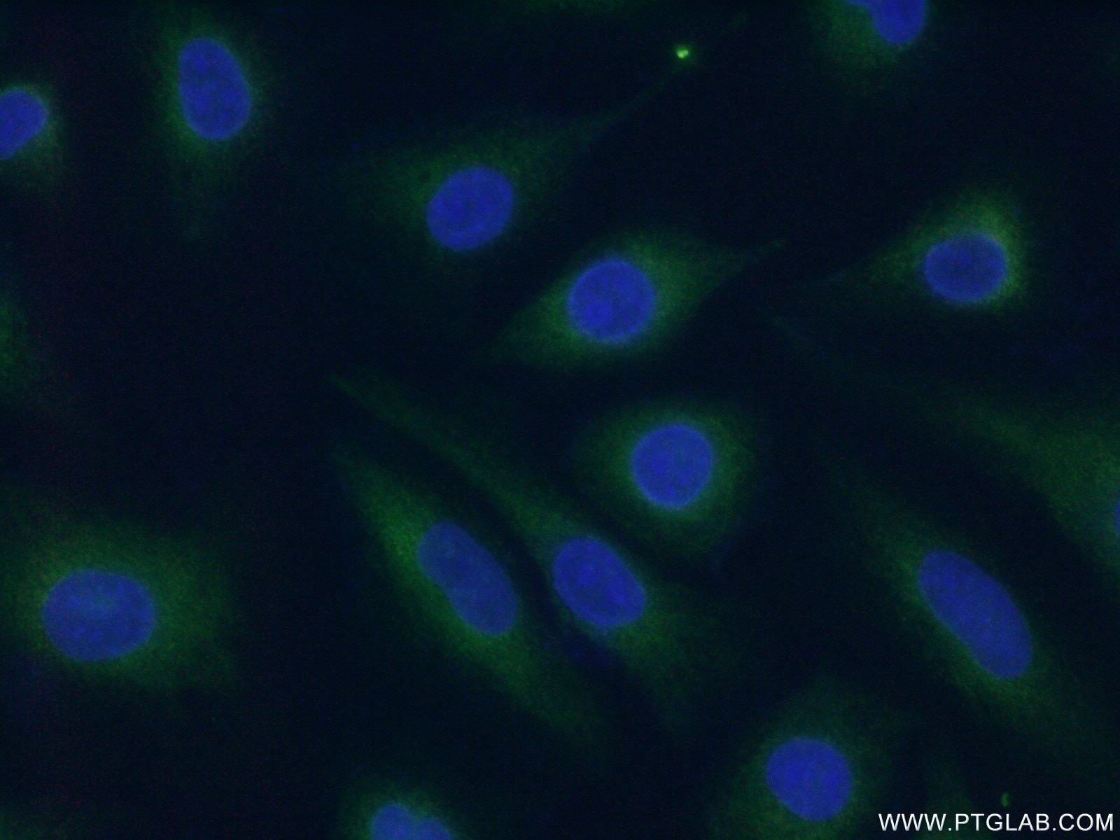 Immunofluorescence (IF) / fluorescent staining of HUVEC cells using TRAF1 Polyclonal antibody (26845-1-AP)