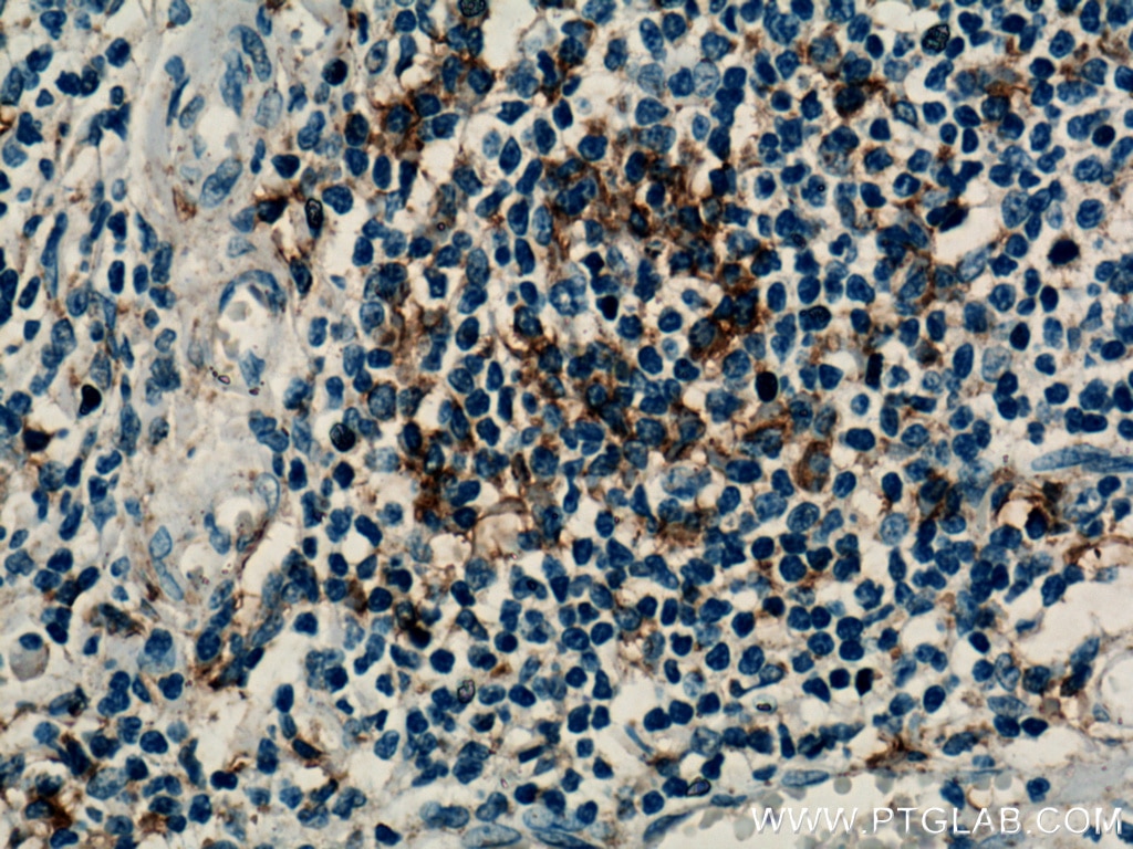 Immunohistochemistry (IHC) staining of human tonsillitis tissue using TRAF1 Polyclonal antibody (26845-1-AP)