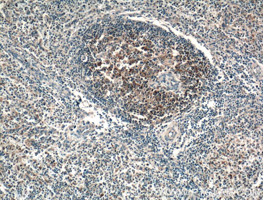 IHC staining of human spleen using 26845-1-AP