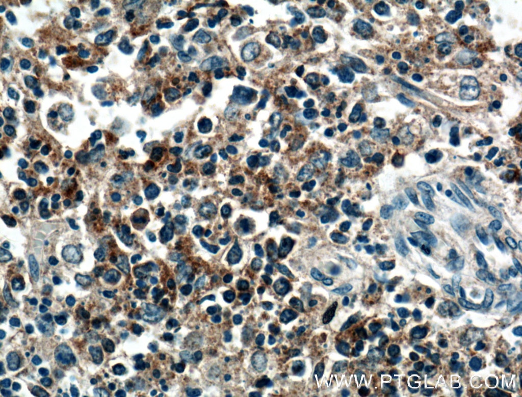 IHC staining of human spleen using 26845-1-AP