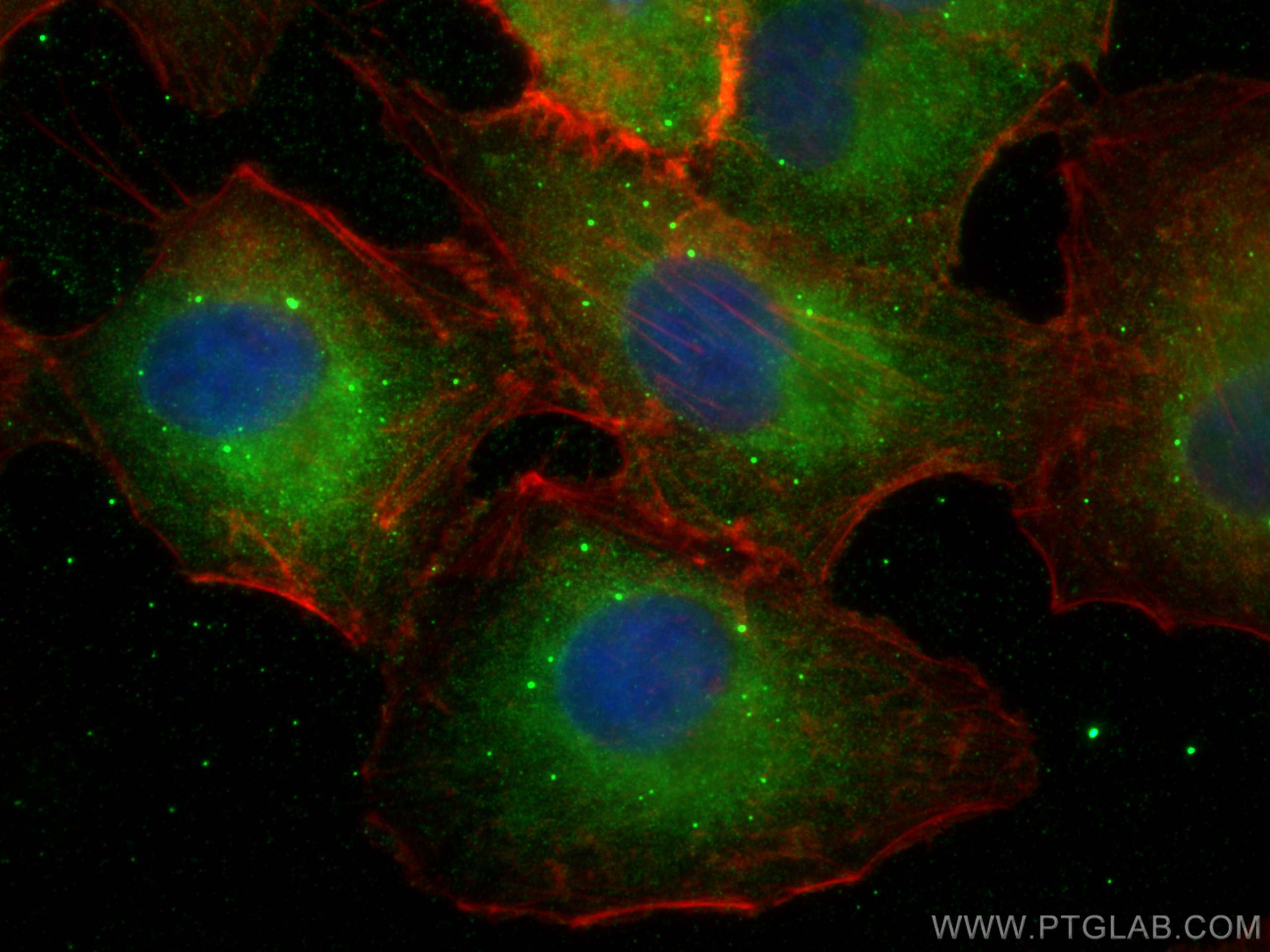 Immunofluorescence (IF) / fluorescent staining of A549 cells using TRAF2 Polyclonal antibody (26846-1-AP)