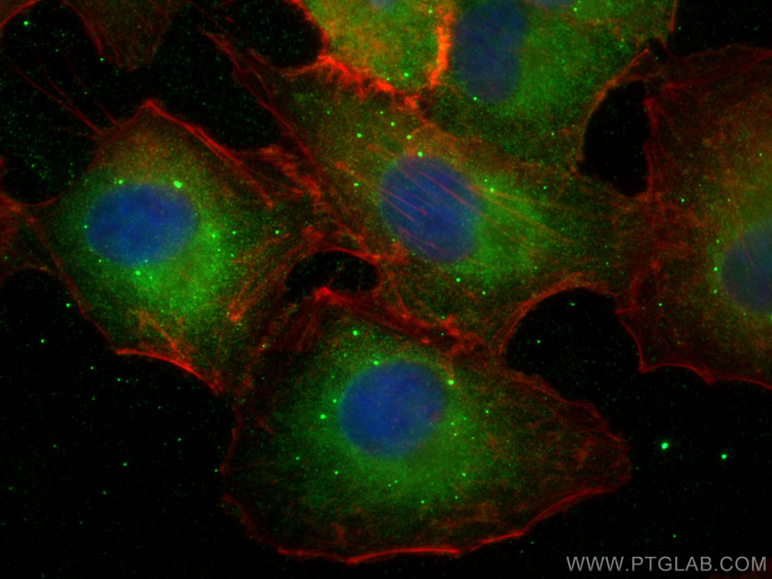 IF Staining of A549 using 26846-1-AP