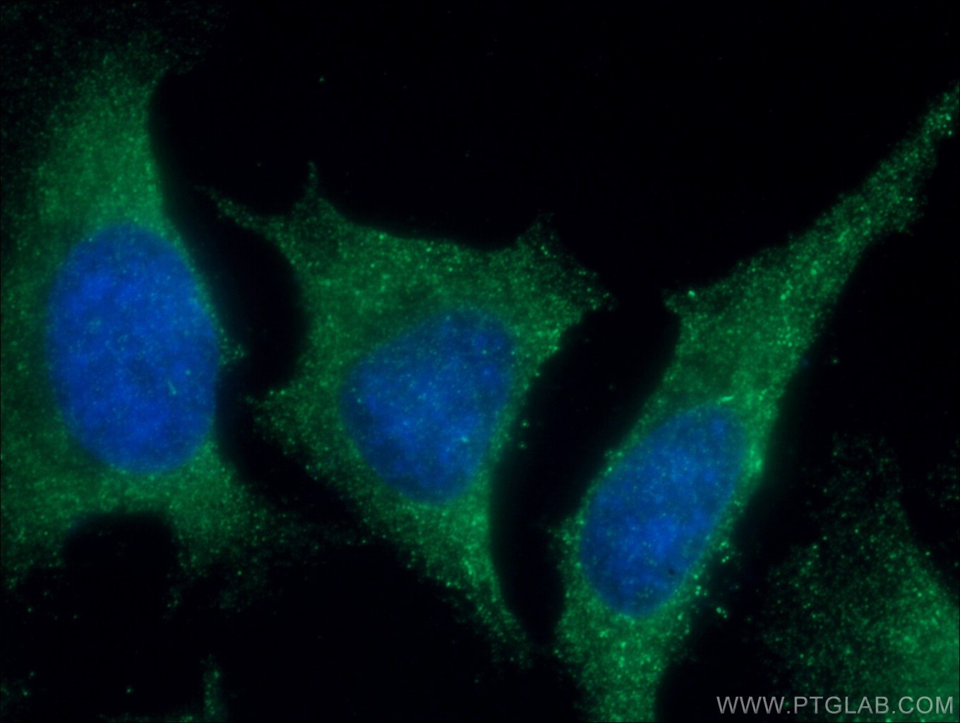 Immunofluorescence (IF) / fluorescent staining of HeLa cells using TRAF2 Polyclonal antibody (26846-1-AP)