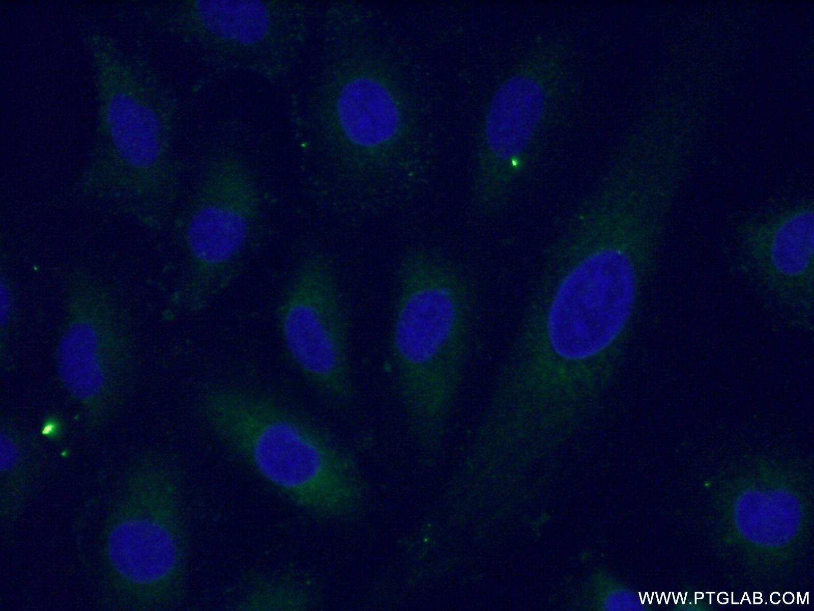 Immunofluorescence (IF) / fluorescent staining of HUVEC cells using TRAF2 Polyclonal antibody (26846-1-AP)