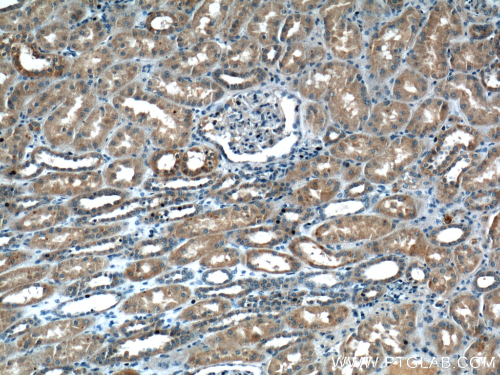 Immunohistochemistry (IHC) staining of human kidney tissue using TRAF2 Polyclonal antibody (26846-1-AP)