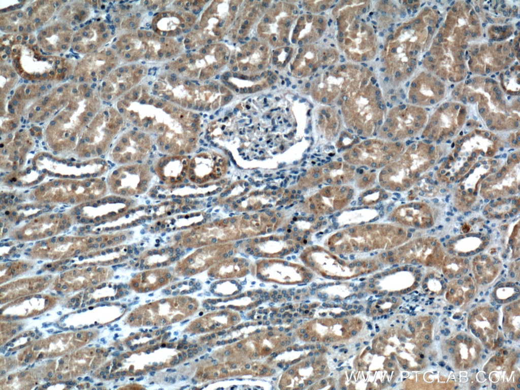 IHC staining of human kidney using 26846-1-AP