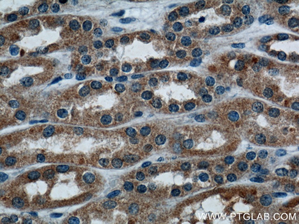 Immunohistochemistry (IHC) staining of human kidney tissue using TRAF2 Polyclonal antibody (26846-1-AP)