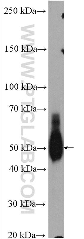 Western Blot (WB) analysis of human testis tissue using TRAF2 Polyclonal antibody (26846-1-AP)