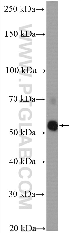 Western Blot (WB) analysis of HeLa cells using TRAF2 Polyclonal antibody (26846-1-AP)