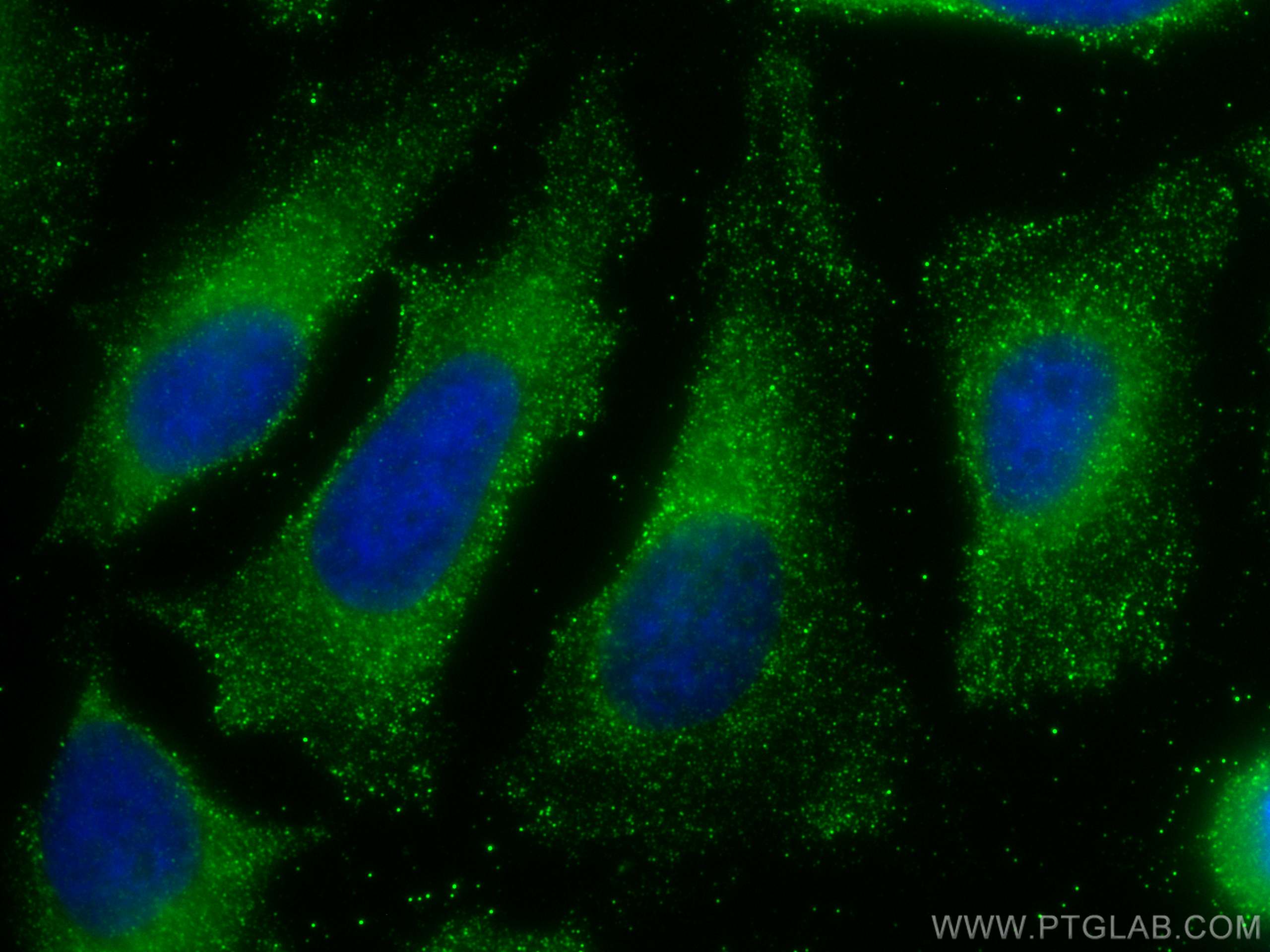 Immunofluorescence (IF) / fluorescent staining of HeLa cells using TRAF2 Monoclonal antibody (67315-1-Ig)