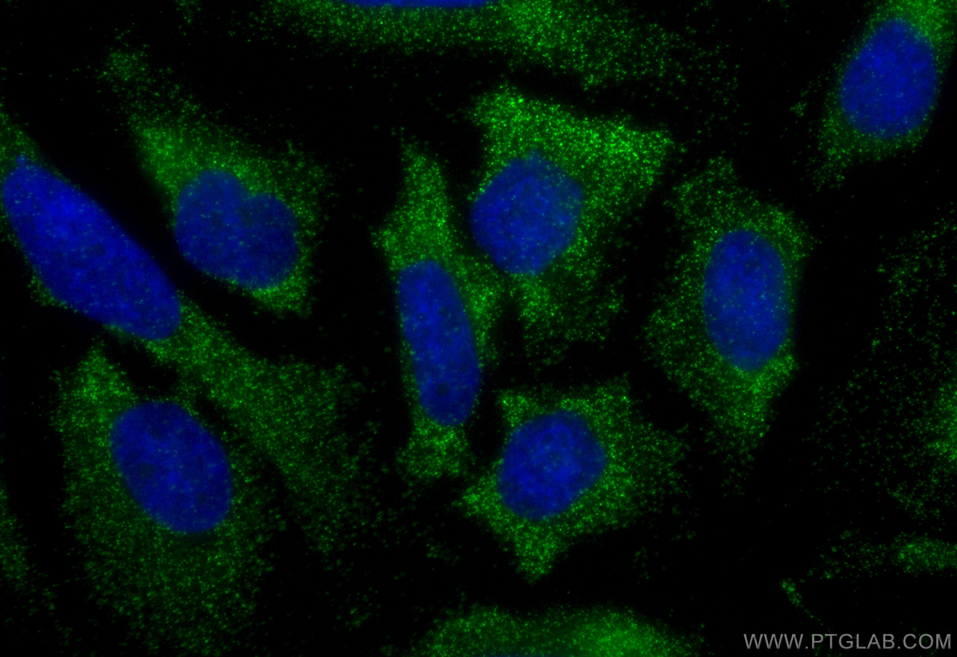 Immunofluorescence (IF) / fluorescent staining of HeLa cells using TRAF2 Recombinant antibody (84581-3-RR)