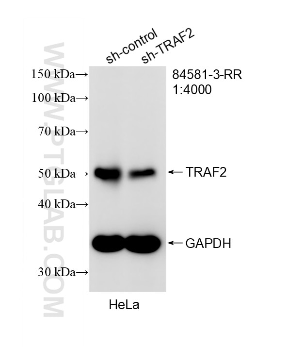Western Blot (WB) analysis of HeLa cells using TRAF2 Recombinant monoclonal antibody (84581-3-RR)