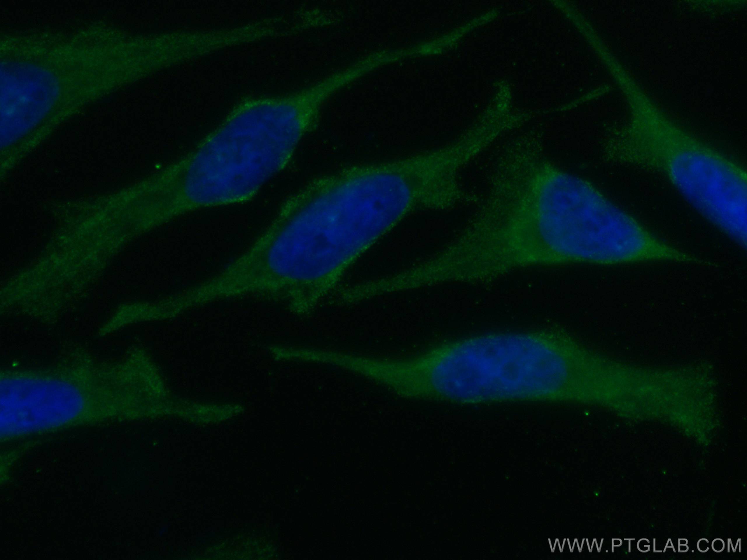 Immunofluorescence (IF) / fluorescent staining of HeLa cells using CoraLite® Plus 488-conjugated TRAF2 Monoclonal ant (CL488-67315)