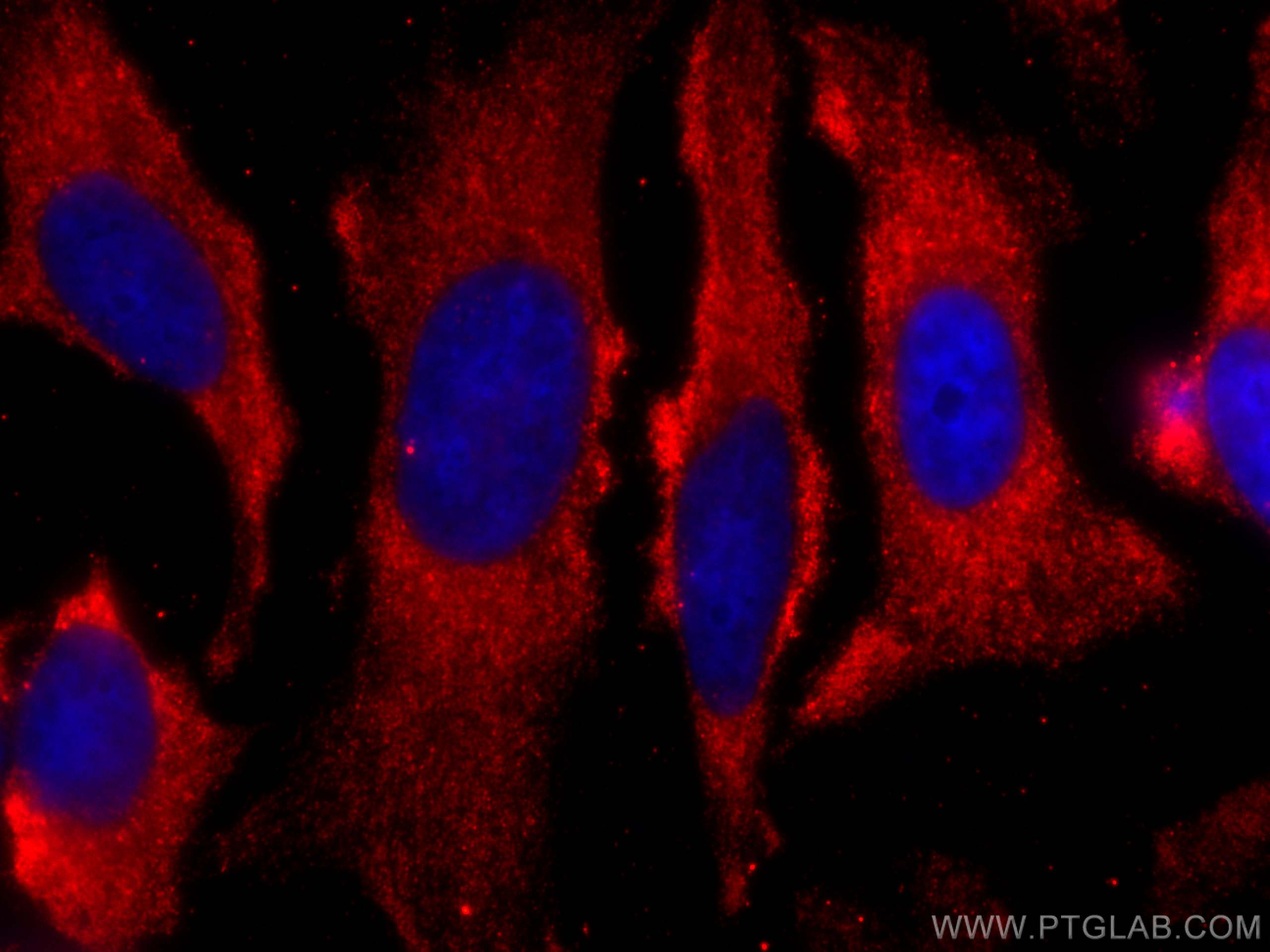 Immunofluorescence (IF) / fluorescent staining of HeLa cells using CoraLite®594-conjugated TRAF2 Monoclonal antibody (CL594-67315)