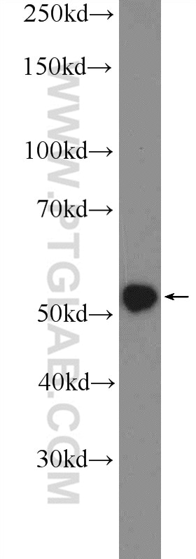 Western Blot (WB) analysis of HEK-293 cells using TRAF3 Polyclonal antibody (18099-1-AP)