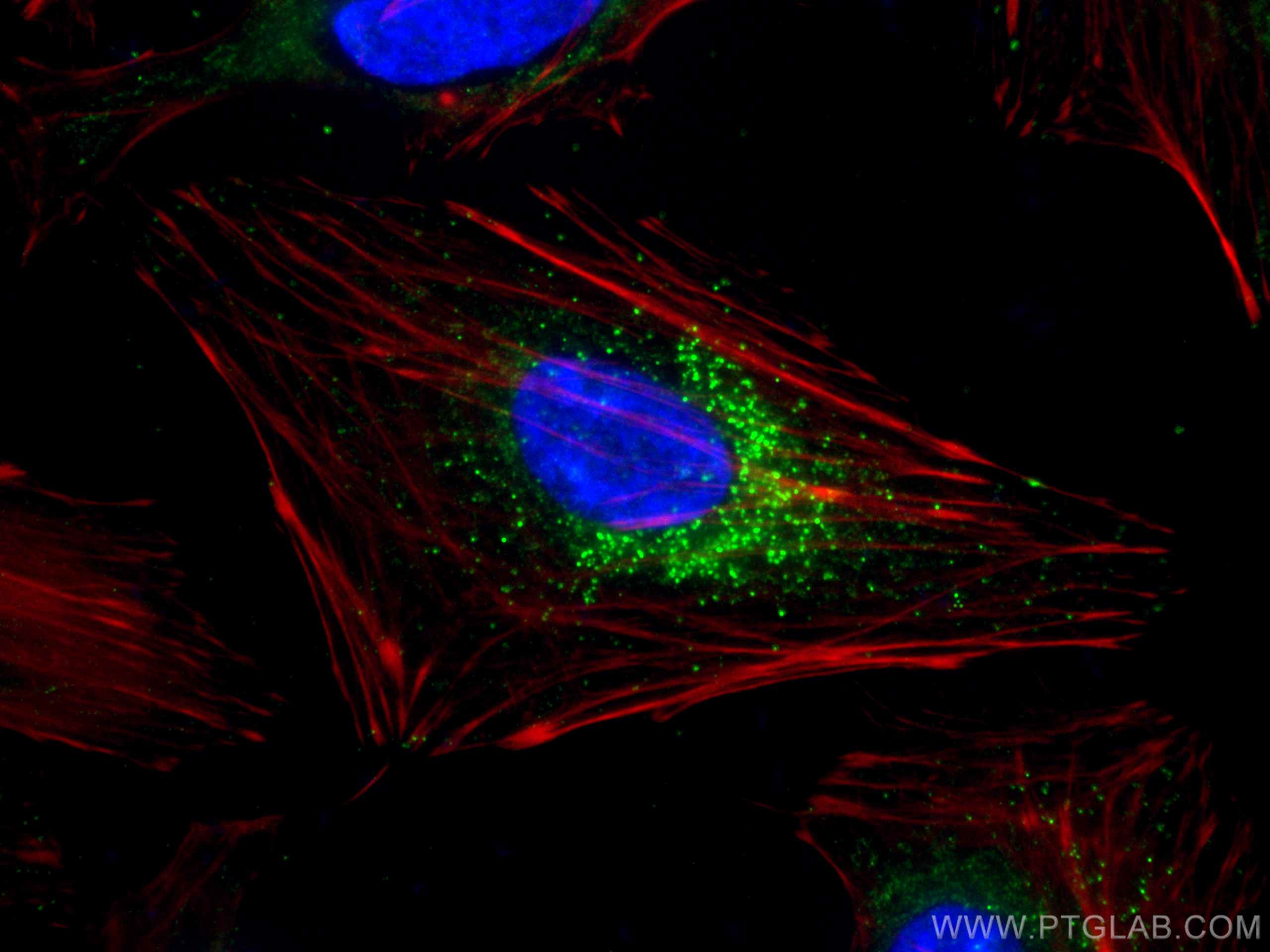 Immunofluorescence (IF) / fluorescent staining of HeLa cells using TRAF3 Monoclonal antibody (66310-1-Ig)