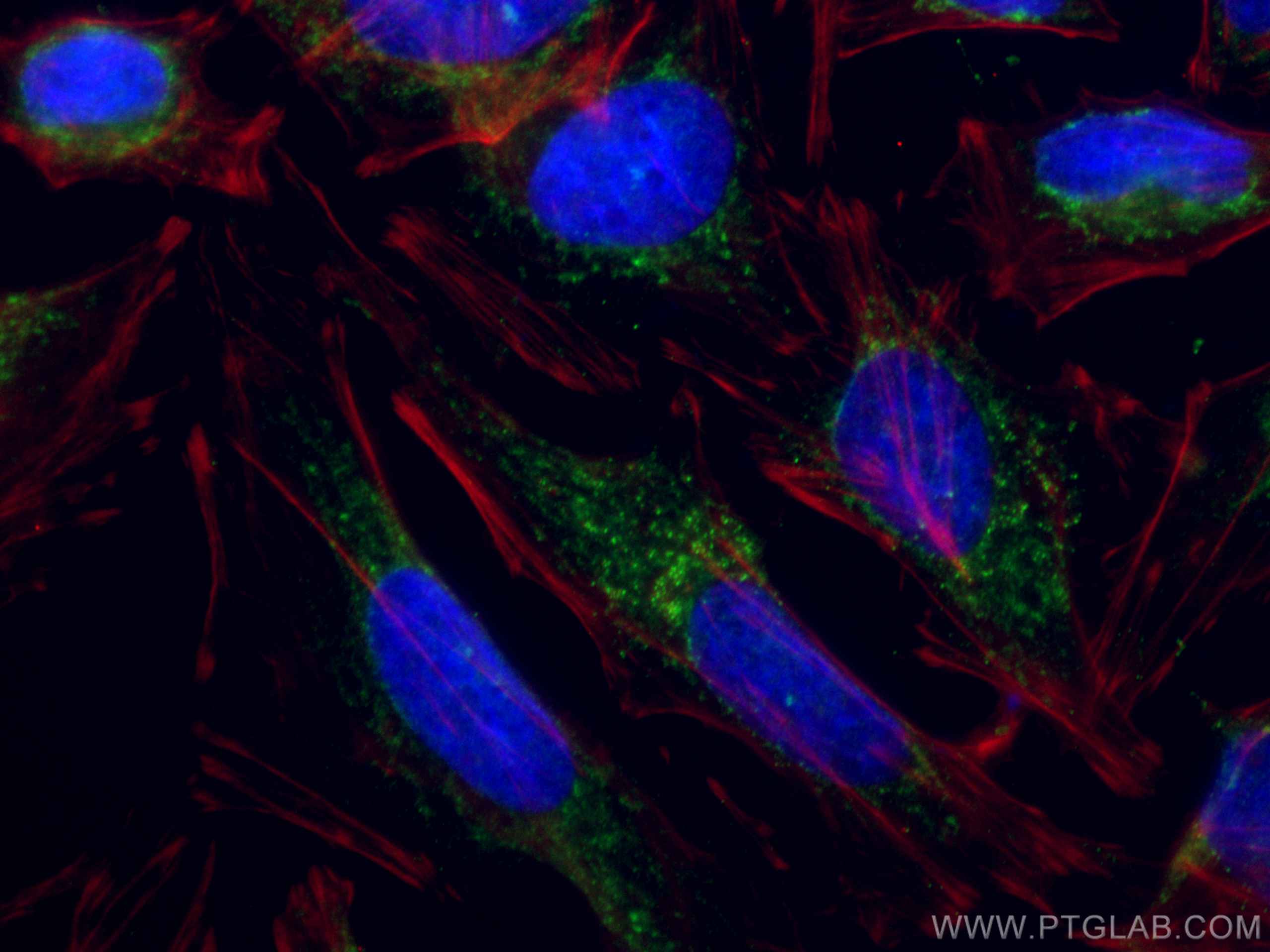 Immunofluorescence (IF) / fluorescent staining of HeLa cells using CoraLite® Plus 488-conjugated TRAF3 Monoclonal ant (CL488-66310)