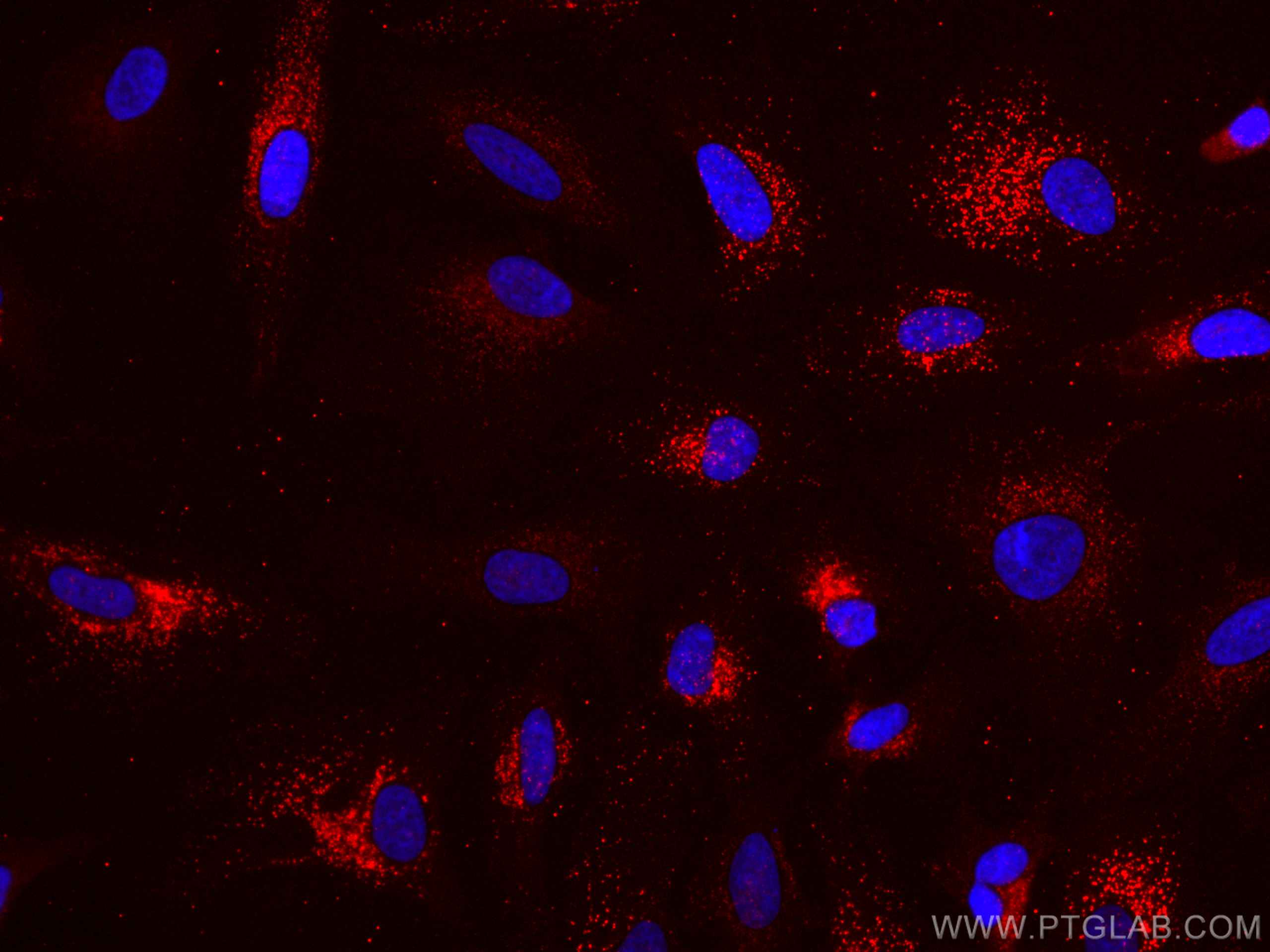 Immunofluorescence (IF) / fluorescent staining of HeLa cells using CoraLite®594-conjugated TRAF3 Monoclonal antibody (CL594-66310)