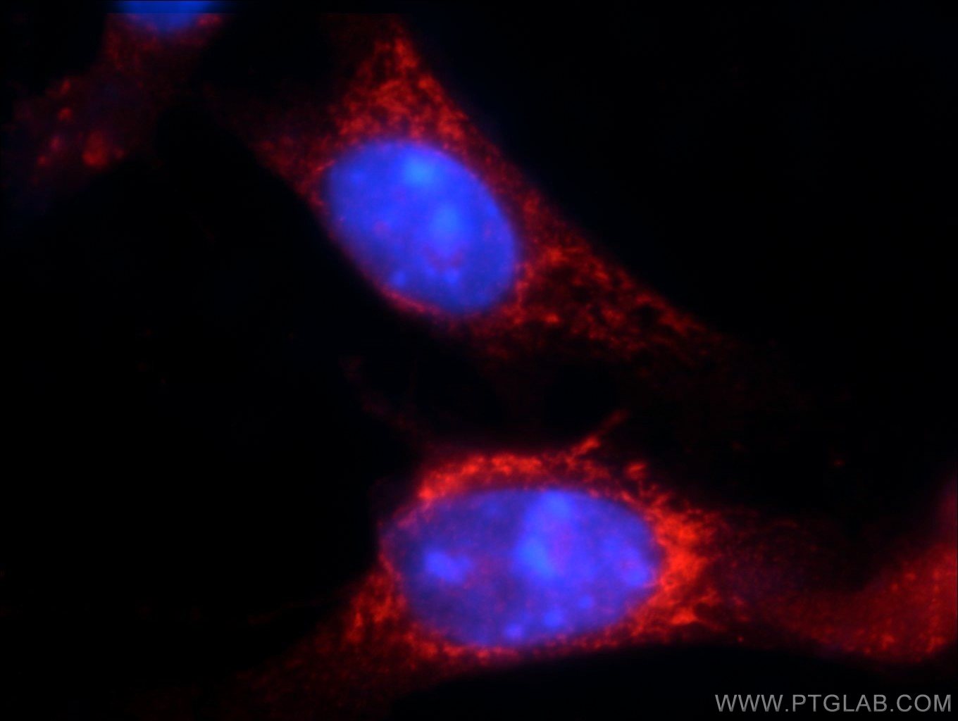 Immunofluorescence (IF) / fluorescent staining of NIH/3T3 cells using TRAF3IP1 Polyclonal antibody (14404-1-AP)