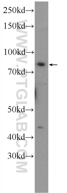 Western Blot (WB) analysis of HEK-293 cells using TRAF3IP1 Polyclonal antibody (14404-1-AP)