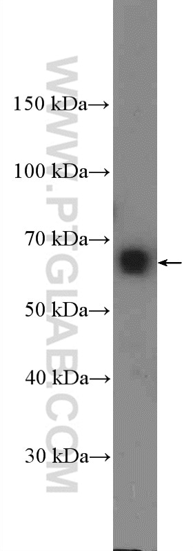Western Blot (WB) analysis of HepG2 cells using TRAF3IP2 Polyclonal antibody (26692-1-AP)