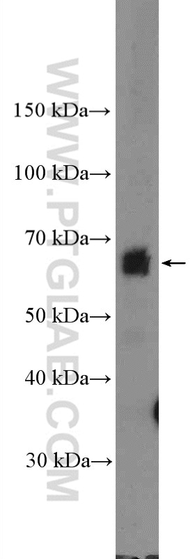 Western Blot (WB) analysis of A549 cells using TRAF3IP2 Polyclonal antibody (26692-1-AP)