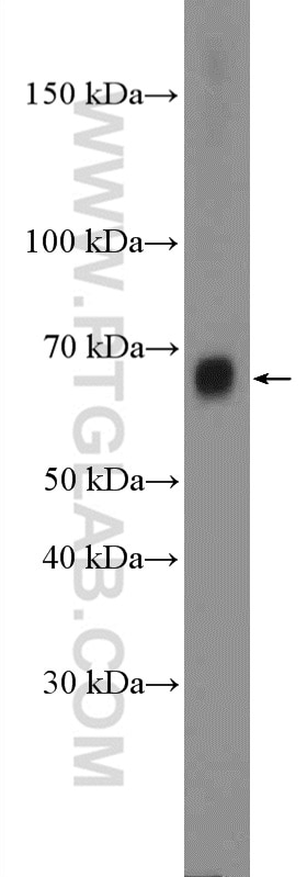 Western Blot (WB) analysis of MCF-7 cells using TRAF3IP2 Polyclonal antibody (26692-1-AP)