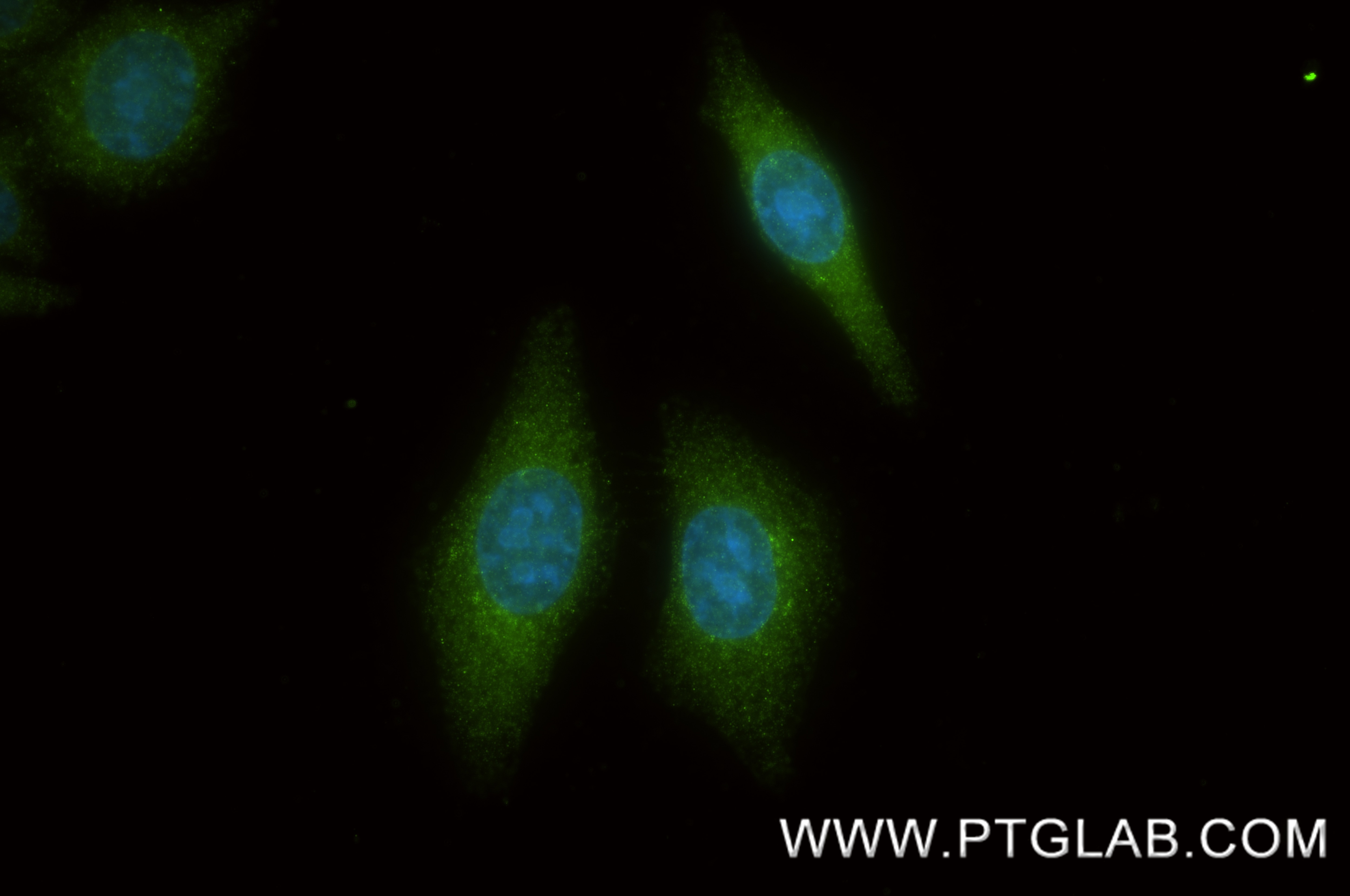 IF Staining of HepG2 using 87596-1-RR (same clone as 87596-1-PBS) Immunofluorescence (IF) / fluorescent staining of HepG2 cells using TRAF3IP2 Recombinant monoclonal antibody (87596-1-RR)