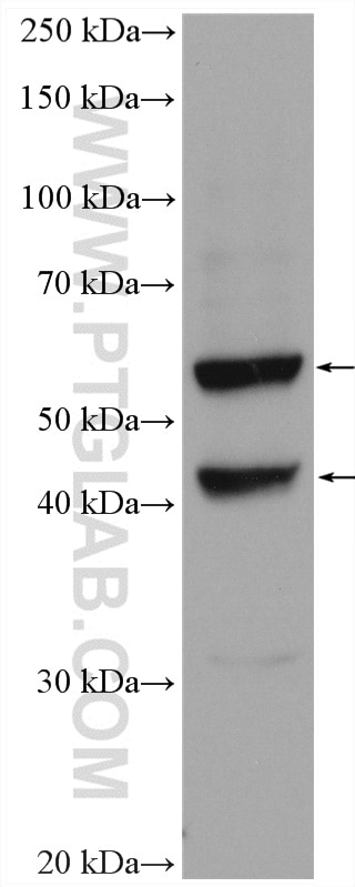Western Blot (WB) analysis of Jurkat cells using TRAF3IP3 Polyclonal antibody (18110-1-AP)