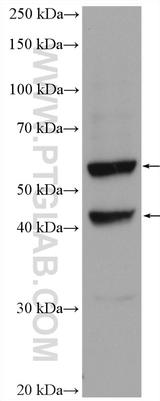 WB analysis of Jurkat using 18110-1-AP