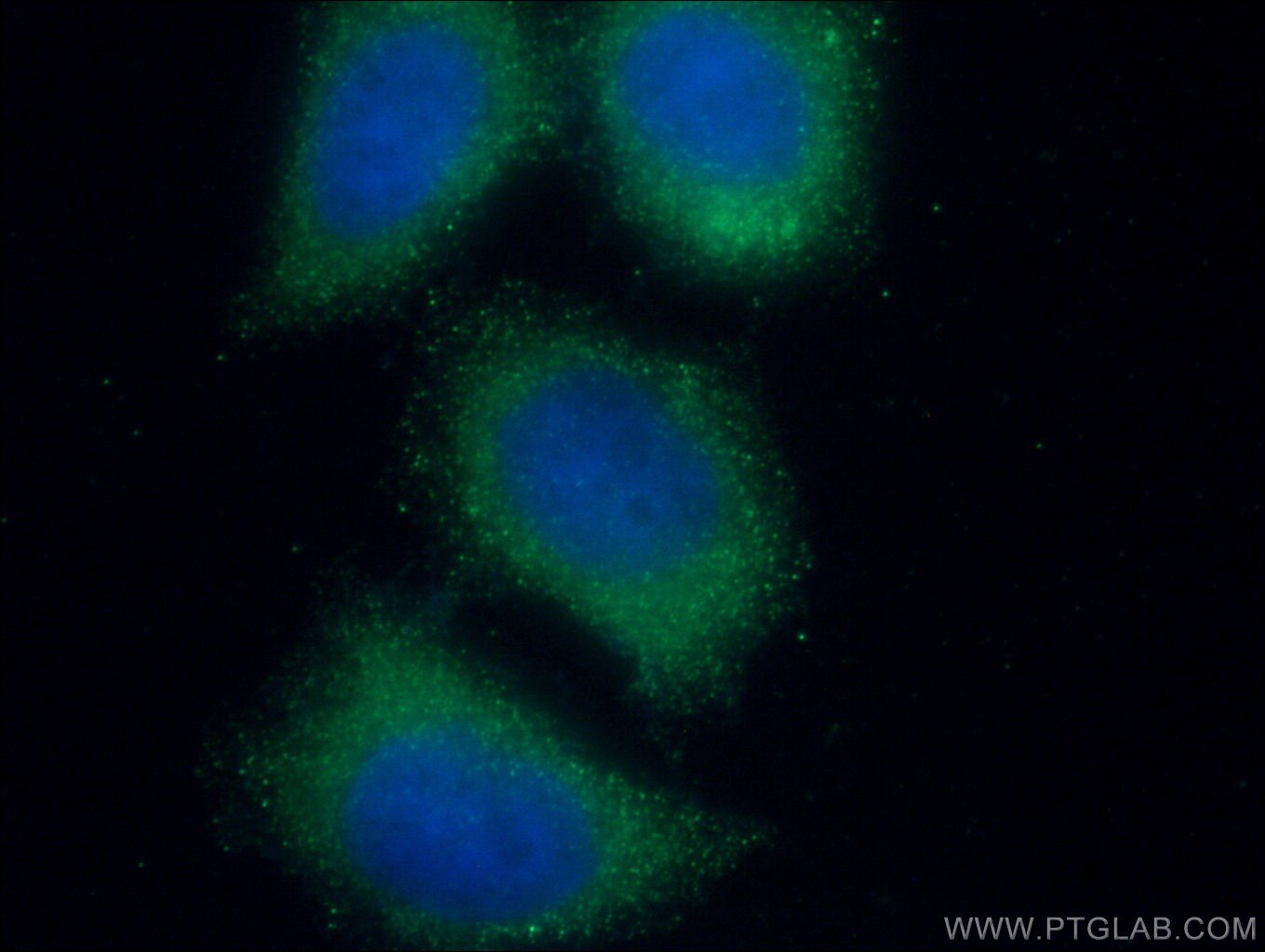 Immunofluorescence (IF) / fluorescent staining of HeLa cells using TRAF4 Monoclonal antibody (66755-1-Ig)