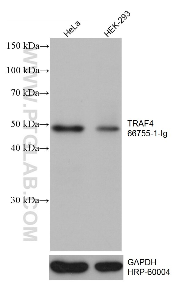 Western Blot (WB) analysis of various lysates using TRAF4 Monoclonal antibody (66755-1-Ig)