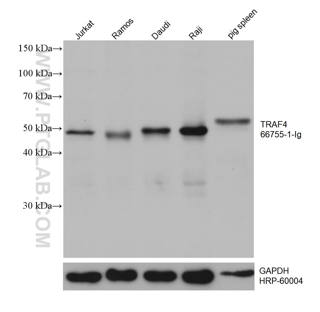 Western Blot (WB) analysis of various lysates using TRAF4 Monoclonal antibody (66755-1-Ig)
