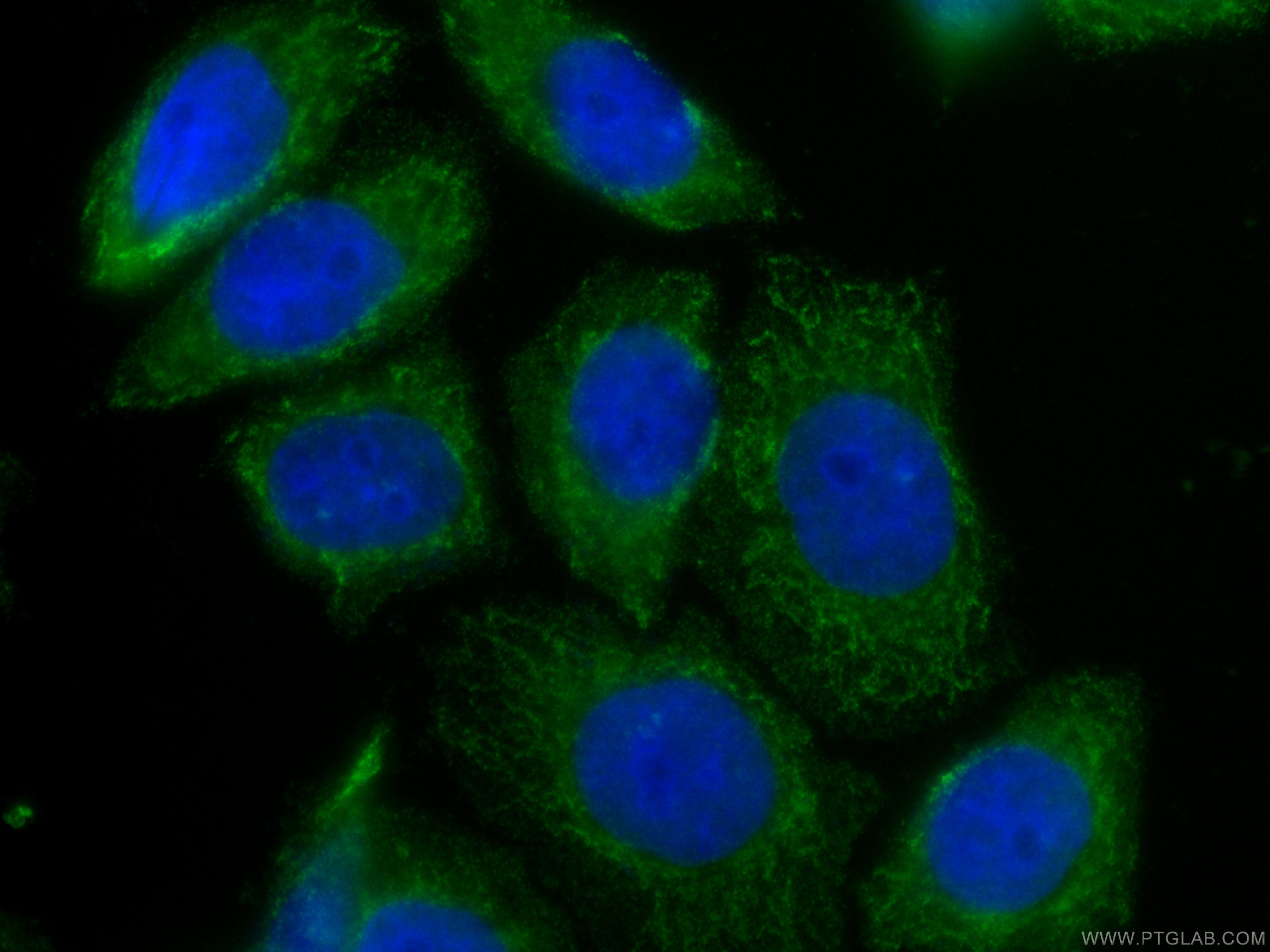 Immunofluorescence (IF) / fluorescent staining of HeLa cells using CoraLite® Plus 488-conjugated TRAF4 Monoclonal ant (CL488-66755)